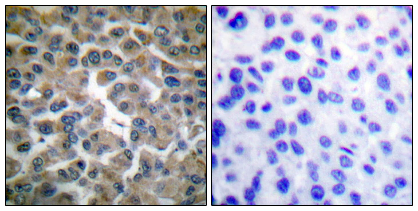 NFKBIE / IKB Epsilon Antibody (aa131-180)