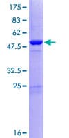 Human DGCR6L Protein (Recombinant GST)