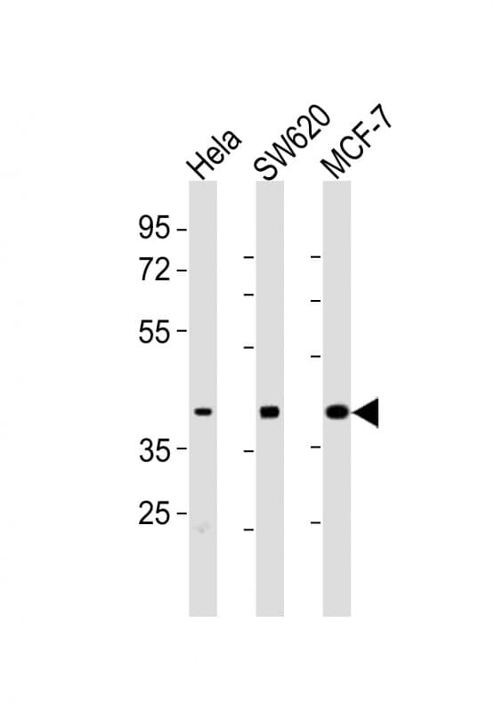 HPN / TMPRSS1 / Hepsin Antibody (aa153-188)