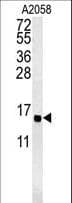 Polyclonal Rabbit anti-Human GOLT1A Antibody (aa103-130, WB)