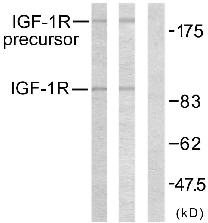 IHC-plus™ IGF1R / IGF1 Receptor Antibody (aa1126-1175)