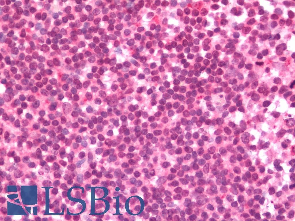 IHC-plus™ Polyclonal Rabbit anti-Human APOBEC3C Antibody (IHC, WB)