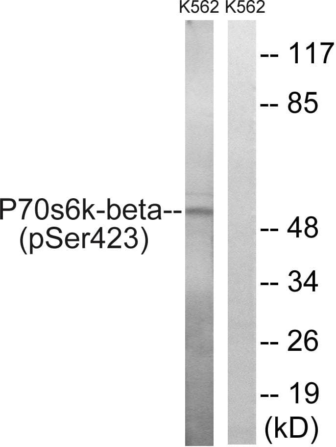 RPS6KB2 / S6K2 Antibody (phospho-Ser423)