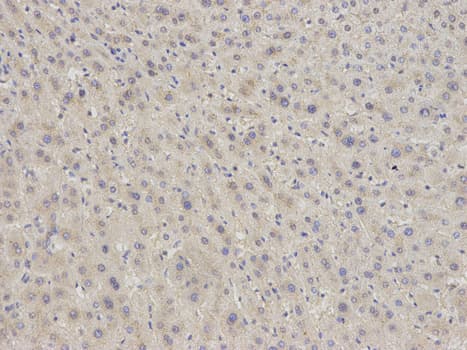 EIF5A Antibody