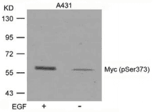 MYC / c-Myc Antibody