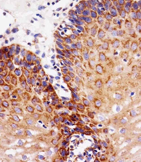 Monoclonal Mouse anti-Human EGFR Antibody (aa1163-1191, IHC, WB)