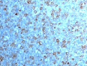 CDK1 / CDC2 Antibody (clone CDK1/873)