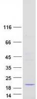Human HDDC3 Protein (Recombinant Myc-DDK (Flag))