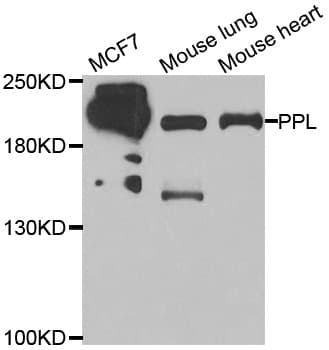 PPL / Periplakin Antibody