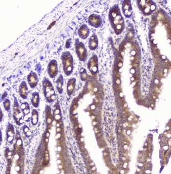 GOLPH3 Antibody