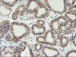 CDH2 / N Cadherin Antibody (clone OTI2G7)