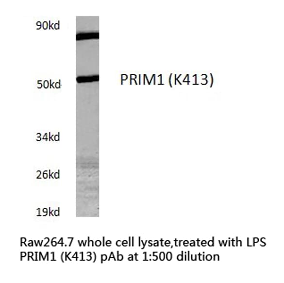 Polyclonal Rabbit anti-Human PRIM1 Antibody (Lys413, IHC, WB)