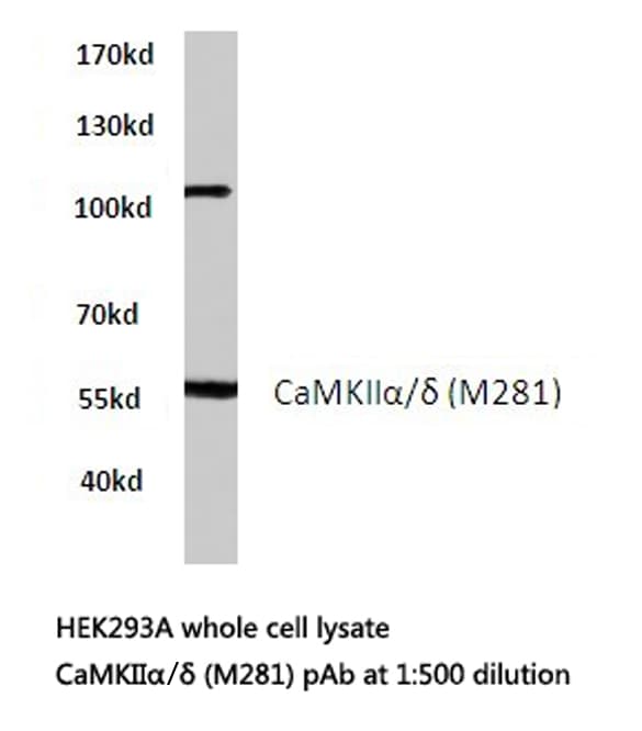 Polyclonal Rabbit anti-Human CaMKII Alpha+Delta Antibody (Met281, IHC, IF, WB)