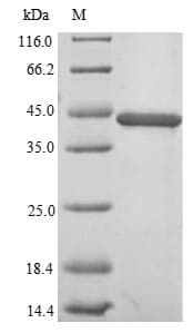Human TDP-43 / TARDBP Protein (Recombinant 6His, N-terminus)