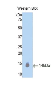 OSM / Oncostatin M Antibody (aa116-205)