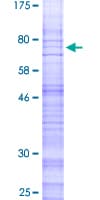 Human CALCRL / CGRP Receptor Protein (Recombinant GST)
