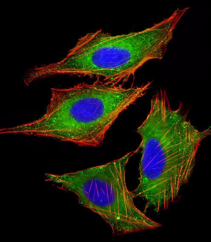 PPP1R13L / iASPP Antibody (aa134-166)