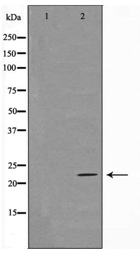 Polyclonal Rabbit anti-Human TNFSF13 / APRIL Antibody (IHC, IF, WB)