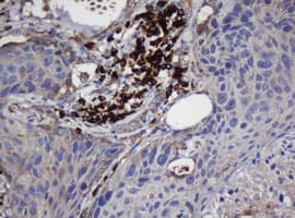 UBE2J1 Antibody (clone OTI3D5, Carrier-free)