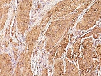 Muscle Actin Antibody (clone SPM160)