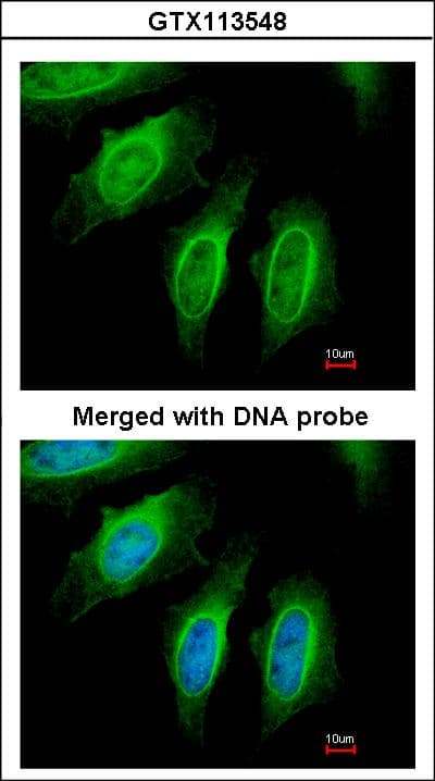 SH3GL1 / EEN Antibody (aa152-368)