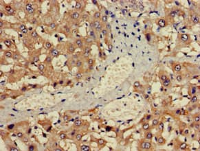Polyclonal Rabbit anti-Human ALAS1 Antibody (IHC)