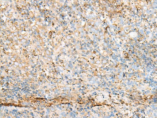 Polyclonal Rabbit anti-Human PDIA4 / ERP72 Antibody (IHC, WB)