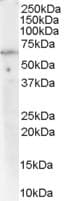 IHC-plus™ Polyclonal Goat anti-Human PPP2R1A Antibody (aa576-589, IHC, WB)