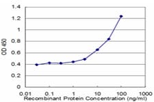 Monoclonal Mouse anti-Human CYP24 / CYP24A1 Antibody (clone 1E1, WB)