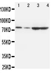 PCSK9 Antibody (aa671-687)