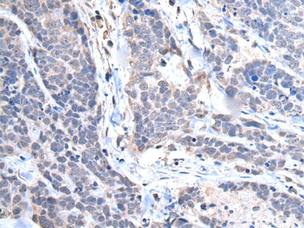TRIM27 Antibody