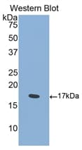 SEMA4D / Semaphorin 4D / CD100 Antibody (aa502-636)