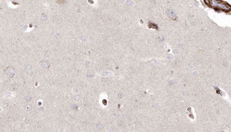 PIEZO1 / FAM38A Antibody