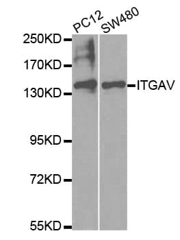 IHC-plus™ Polyclonal Rabbit anti-Human ITGAV/Integrin Alpha V/CD51 Antibody (IHC, WB)