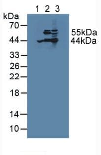 ACAT2 Antibody (aa1-397, PE)