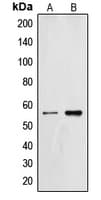 ZNF187 Antibody (Internal)