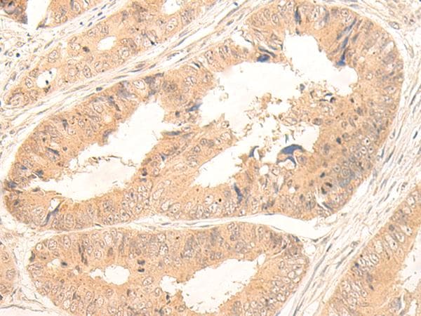 FABP4 / AP2 Antibody