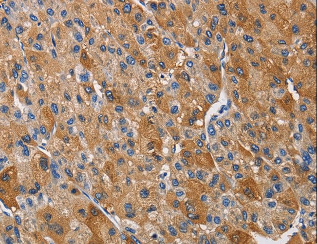 KLK1 / Kallikrein 1 Antibody
