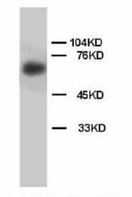 Lamin B Antibody (aa570-586)