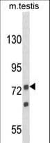 ANGEL1 Antibody (aa597-624)