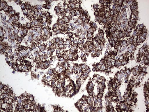 PIK3CD / PI3K Delta Antibody (aa286-610, clone OTI1D11)