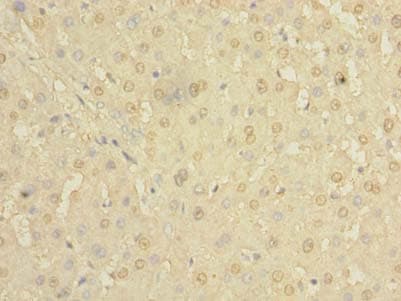 HBE1 / Hemoglobin Epsilon 1 Antibody