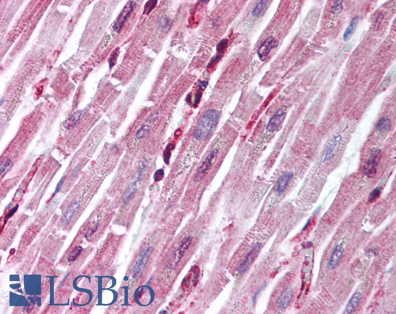 IHC-plus™ Polyclonal Rabbit anti-Human PTPN11 / SHP-2 / NS1 Antibody (IHC, WB)