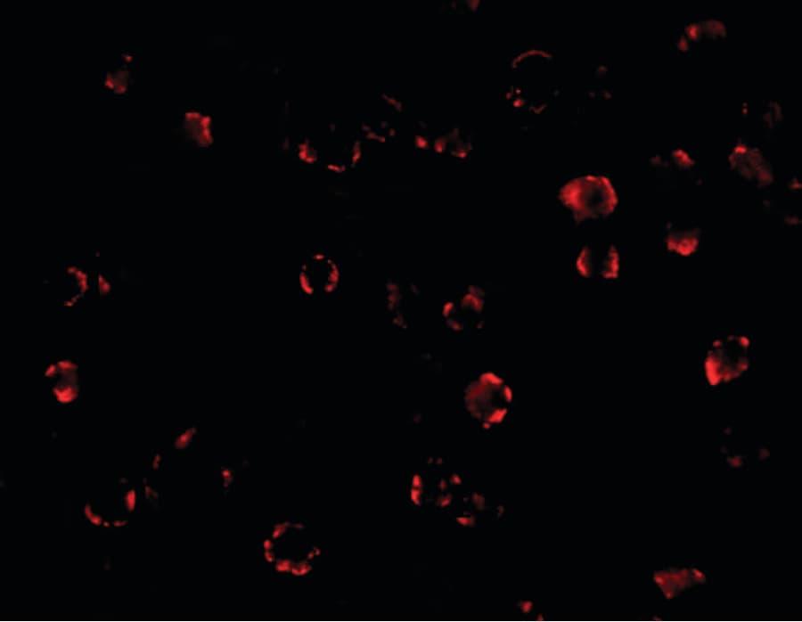 Polyclonal Rabbit anti-Human MATN3 / Matrilin 3 Antibody (IF, WB)