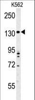 TMEM132D Antibody (aa805-833)