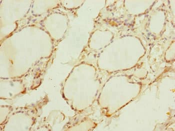 TIMM10B / FXC1 Antibody
