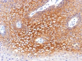 JUP/CTNNG/Junction Plakoglobin Antibody (clone CTNG/1483)