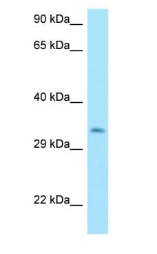 MTX3 Antibody (C-Terminus)