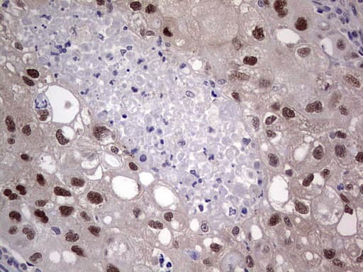 MDM2 Antibody (aa119-438, clone OTI8C6)