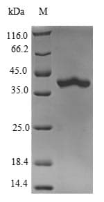 Human RAB5B Protein (Recombinant GST, N-terminus)